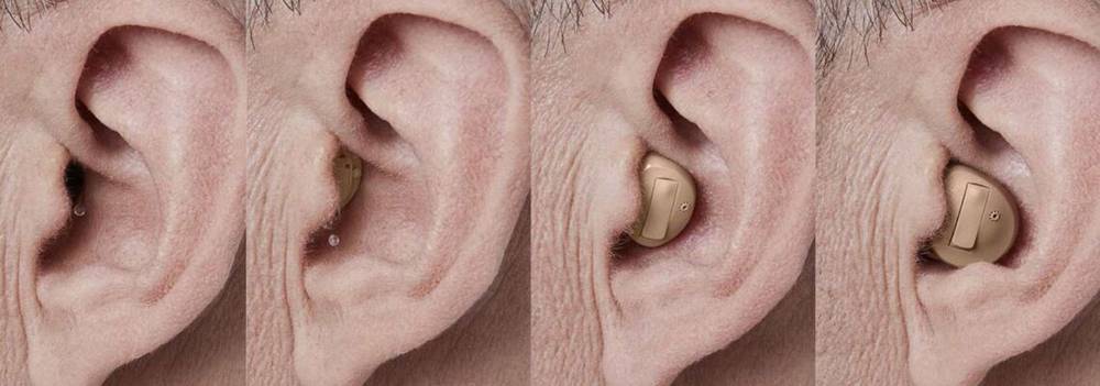 5 Best Invisible Hearing Aids In 2024